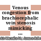 Venous congestion from brachiocephalic vein stenosis mimicking sclerotic vertebral lesions