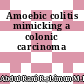 Amoebic colitis mimicking a colonic carcinoma