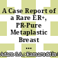 A Case Report of a Rare ER+, PR-Pure Metaplastic Breast Squamous Cell Carcinoma with HER2 Overexpression