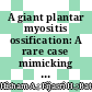 A giant plantar myositis ossification: A rare case mimicking an osteosarcoma